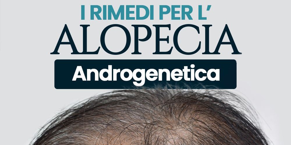 I rimedi per l'alopecia androgenetica