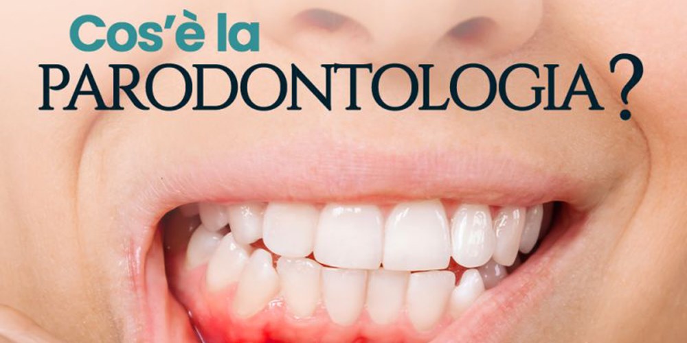 Cos'è la parodontologia?