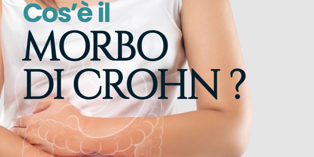 Cos'e' il morbo di Crohn?