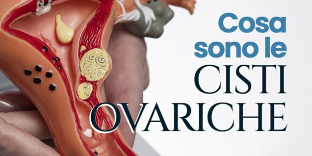 Poliambulatorio Panacea - Cosa sono le cisti ovariche