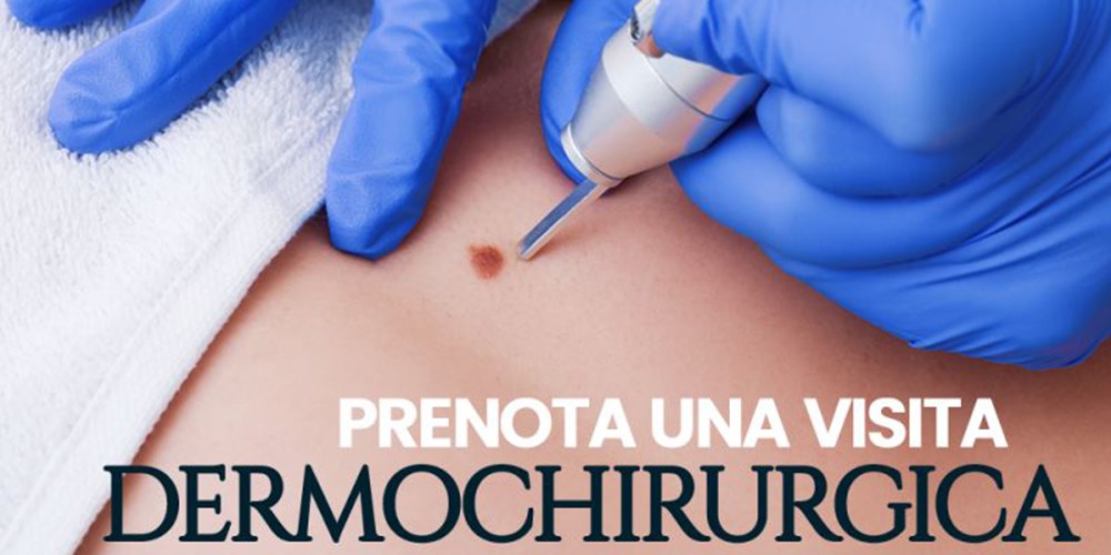 Prenota una visita dermochirurgica