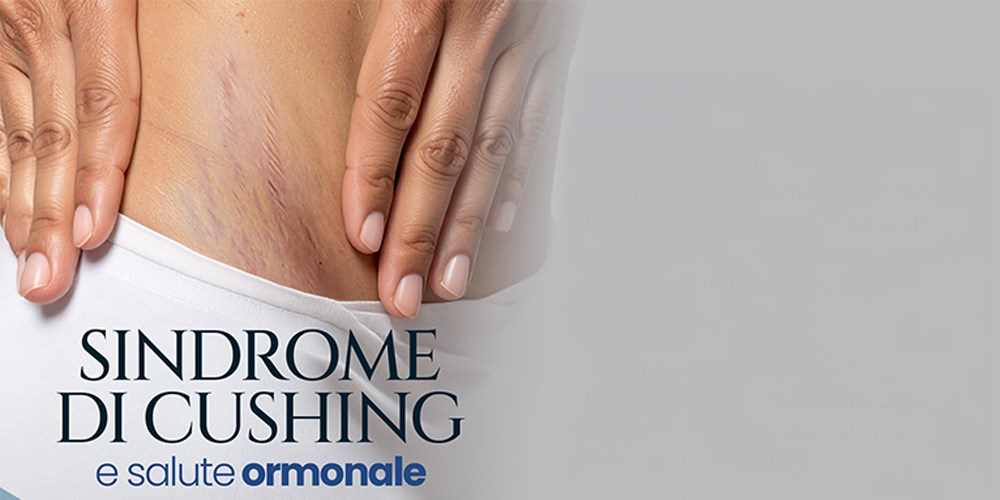 Sindrome di Cushing e salute ormonale