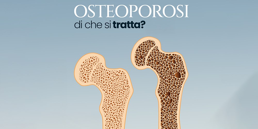 Osteoporosi di che si tratta?